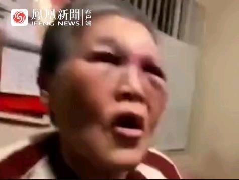 美国华裔老太自述“遇袭后反将袭击者打到躺担架