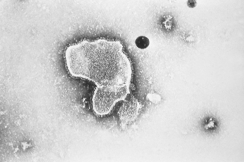 电子显微镜下的呼吸道合胞病毒RSV
